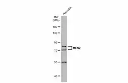 Anti-MFN2 antibody used in Western Blot (WB). GTX134774