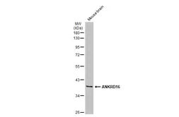 Anti-ANKRD16 antibody used in Western Blot (WB). GTX134803