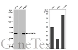 Anti-IGF2BP1 antibody used in Western Blot (WB). GTX134816