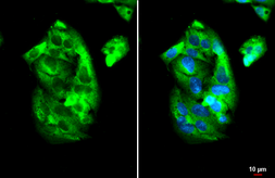 Anti-IGF2BP2 antibody used in Immunocytochemistry/ Immunofluorescence (ICC/IF). GTX134817