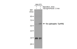 Anti-Src (phospho Tyr416) antibody used in Western Blot (WB). GTX134837