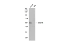 Anti-SOX17 antibody used in Western Blot (WB). GTX134849