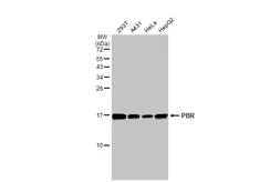 Anti-PBR antibody used in Western Blot (WB). GTX134851