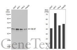 Anti-DLST antibody used in Western Blot (WB). GTX134855