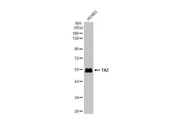 Anti-TAZ antibody used in Western Blot (WB). GTX134857