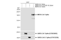 Anti-MERS-CoV Spike (S1) antibody used in Western Blot (WB). GTX134864