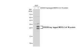 Anti-MERS-CoV M protein antibody used in Western Blot (WB). GTX134866