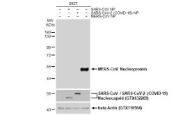 Anti-MERS-CoV Nucleoprotein antibody used in Western Blot (WB). GTX134868