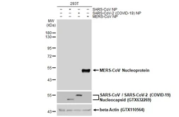 Anti-MERS-CoV Nucleoprotein antibody used in Western Blot (WB). GTX134868