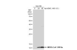 Anti-MERS-CoV ORF4a antibody used in Western Blot (WB). GTX134869