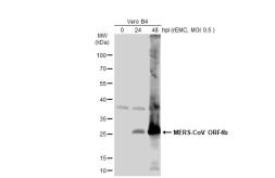 Anti-MERS-CoV ORF4b antibody used in Western Blot (WB). GTX134870