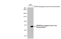Anti-Lassa virus Nucleoprotein antibody used in Western Blot (WB). GTX134884