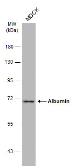 Anti-Albumin antibody - VetSignal used in Western Blot (WB). GTX134897