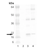 Anti-Hsp20 antibody used in Western Blot (WB). GTX13491