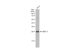 Anti-Bcl-2 antibody - VetSignal used in Western Blot (WB). GTX134923