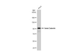 Anti-beta Catenin antibody - VetSignal used in Western Blot (WB). GTX134941