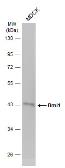 Anti-Bmi1 antibody - VetSignal used in Western Blot (WB). GTX134944