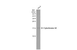 Anti-Cytochrome b5 antibody - VetSignal used in Western Blot (WB). GTX134962