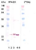 Anti-alpha B Crystallin antibody used in Western Blot (WB). GTX13497