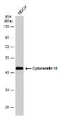 Anti-Cytokeratin 18 antibody - VetSignal used in Western Blot (WB). GTX134975