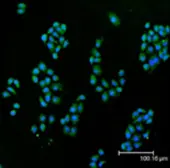Anti-SOD1 antibody used in Immunocytochemistry/ Immunofluorescence (ICC/IF). GTX13498