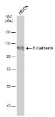 Anti-E-Cadherin antibody - VetSignal used in Western Blot (WB). GTX134997