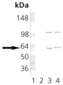 Anti-TCP1 alpha antibody [23c] used in Western Blot (WB). GTX13501