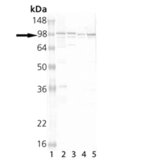 Anti-Calnexin antibody used in Western Blot (WB). GTX13504
