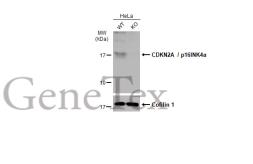 Anti-CDKN2A / p16INK4a antibody used in Western Blot (WB). GTX135119