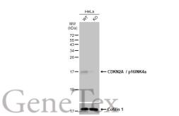 Anti-CDKN2A / p16INK4a antibody used in Western Blot (WB). GTX135120