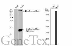Anti-Myeloperoxidase antibody used in Western Blot (WB). GTX135125