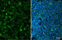 Anti-Myeloperoxidase antibody used in Immunocytochemistry/ Immunofluorescence (ICC/IF). GTX135127