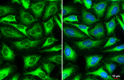 Anti-MFF antibody used in Immunocytochemistry/ Immunofluorescence (ICC/IF). GTX135140
