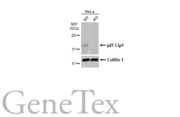 Anti-p21 Cip1 antibody used in Western Blot (WB). GTX135142