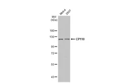 Anti-CP110 antibody used in Western Blot (WB). GTX135150