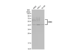 Anti-CD63 antibody used in Western Blot (WB). GTX135220