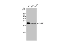 Anti-PERP antibody used in Western Blot (WB). GTX135223