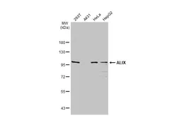 Anti-ALIX antibody used in Western Blot (WB). GTX135226