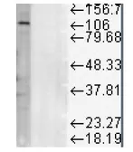 Anti-LAMP1 antibody [Ly1C6] used in Western Blot (WB). GTX13523