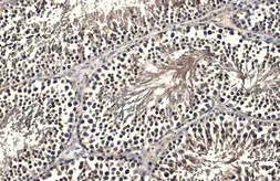 Anti-FOXO1 antibody used in IHC (Paraffin sections) (IHC-P). GTX135251