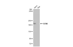 Anti-GCN2 antibody used in Western Blot (WB). GTX135252