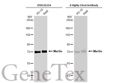 Anti-Merlin antibody used in Western Blot (WB). GTX135254