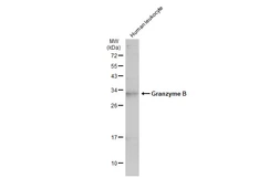 Anti-Granzyme B antibody used in Western Blot (WB). GTX135274