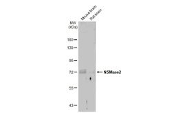 Anti-NSMase2 antibody used in Western Blot (WB). GTX135275