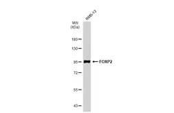 Anti-FOXP2 antibody used in Western Blot (WB). GTX135285