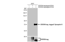 Anti-Synapsin II antibody used in Western Blot (WB). GTX135310