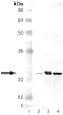 Anti-SOD2 antibody used in Western Blot (WB). GTX13533