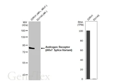 Anti-Androgen Receptor (ARv7 Splice Variant) antibody used in Western Blot (WB). GTX135345