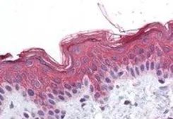 Anti-ADAM17 antibody used in IHC (Paraffin sections) (IHC-P). GTX13535
