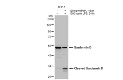 Anti-Gasdermin D antibody used in Western Blot (WB). GTX135366